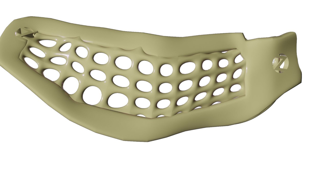 PEEK AccuraPlate™